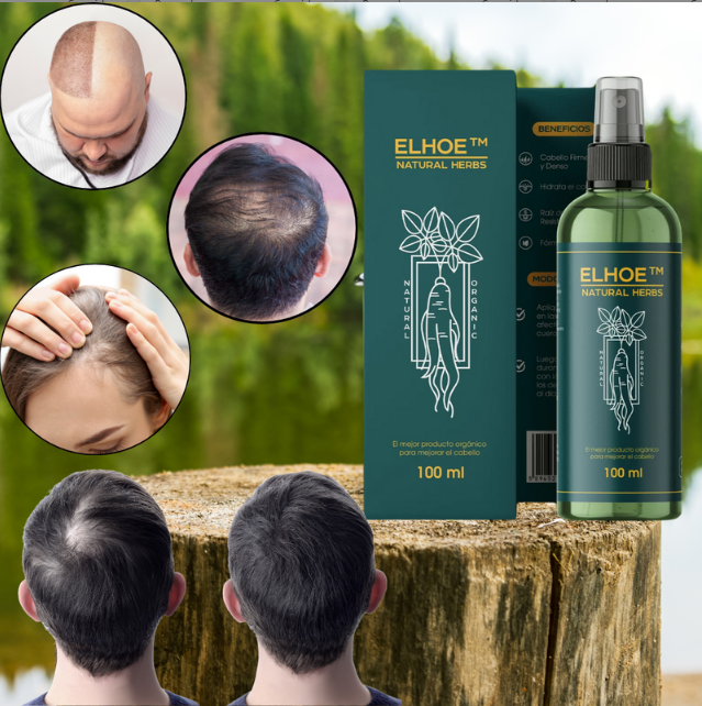 Elhoe - Fortalece tu Cabello Desde la Raíz